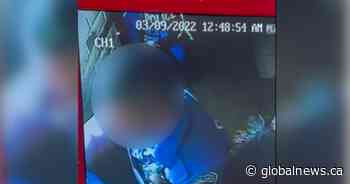 Resident claims he suffered fracture, cuts during interaction with Hamilton police | Globalnews.ca - Global News