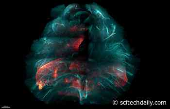 New HYBRiD Technique for Making Tissue Transparent Could Speed the Study of Many Diseases