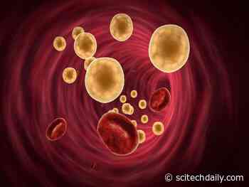 Higher Blood Fats More Harmful Than Previously Thought – Can Damage Muscle Cells