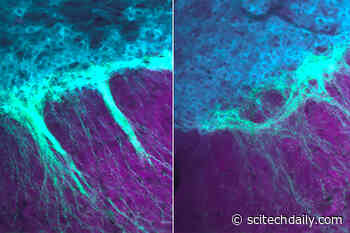 New Harmful Side Effects of Marijuana Discovered – Developing Brain Needs Cannabinoid Receptors After Birth