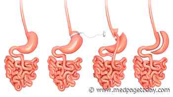 Who Gets Heart Benefits From Bariatric Surgery? Study Casts a Wider Net