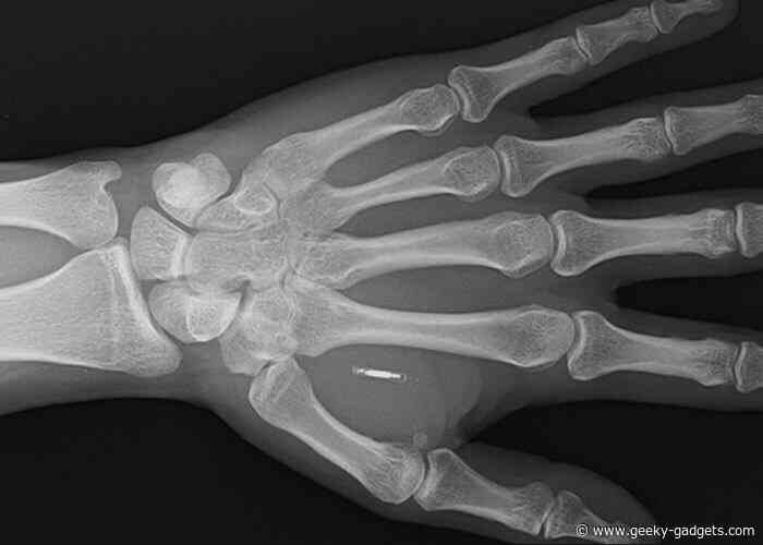 Biohacker embeds contactless payment chip under skin