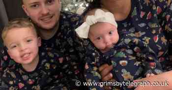 Baby with severe red eczema “cured overnight” by £7.99 cream - Grimsby Live - Grimsby Live