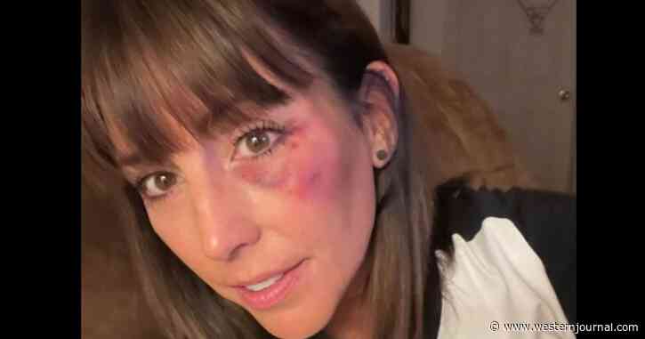 Softball Umpire Issues Message to Spectators After Ambush Leaves Her with Black Eye
