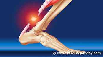 Achilles' Tendon Rupture Surgery Not So Necessary?