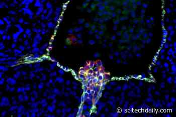 Scientists Create First Comprehensive Map of Human Blood Stem Cell Development