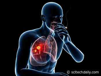DNA Mutation Research Reveals Why Most Smokers Never Get Lung Cancer