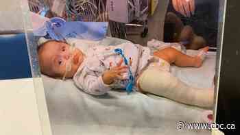 Family calling for answers after baby's leg broken at Jim Pattison Children's Hospital