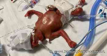 Miracle Solihull baby defies the odds after mum's waters broke at 22 weeks - Birmingham Live