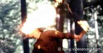 Tenta di bruciare l'erba ma la benzina finisce sul volto, grave ustionato a Corato ricoverato d'urgenza a Bari - VideoAndria.com