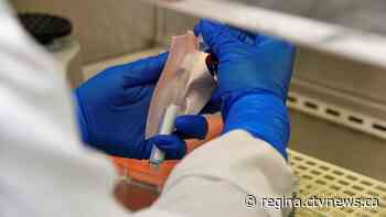 Sask. reports 20 COVID-19 deaths for week of April 3-9