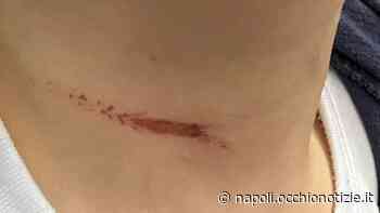 Pomigliano D’Arco, bimbo di 5 anni rischia di restare impiccato mentre gioca sull’altalena - L'Occhio di Napoli