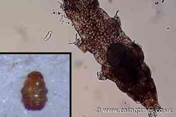 Tardigrades 'can hitch rides on snails but the slime hampers survival' - Ealing Times