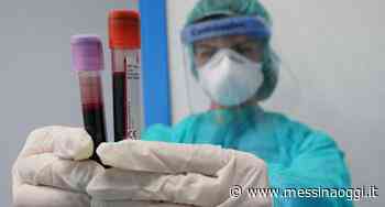 Covid: oltre 3700 nuovi positivi, 817 a Messina - Messina Oggi