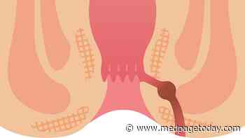 Crohn's Fistulas Heal Better With Combined Surgical-TNF Blocker Approach