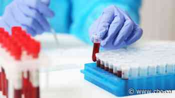 Privatization of Alberta community lab services delayed until December