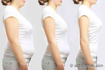 The Benefits of a Healthy Gut Microbiome for Weight Loss