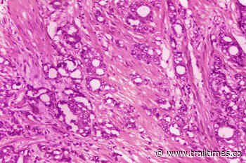 Doctors suggest new names for low-grade prostate cancer - Trail Times