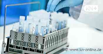 Werden die Corona-Zahlen für Schleswig-Holstein bald nicht mehr täglich veröffentlicht?