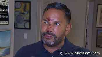 Fort Lauderdale Man Says He Was Attacked for Being Gay
