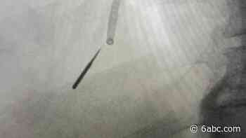 Illinois man inhales drill bit into lung during dentist visit - WPVI-TV