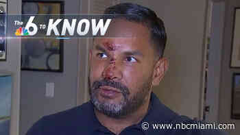 6 to Know: Fort Lauderdale Man Says He Was Attacked for Being Gay