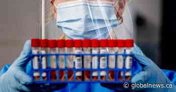 What immunocompromised Canadians need to know amid rising COVID-19 cases