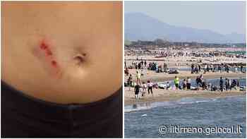 Marina di Massa, bambina di 6 anni aggredita da un cane in spiaggia. Il racconto choc del padre - Il Tirreno