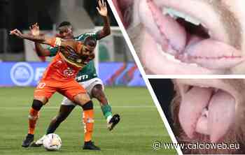 Oscar Benitez si opera per avere la lingua biforcuta come una lucertola: l’argentino diventa un R ... - CalcioWeb