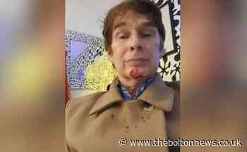 Dog attacks man in Northern Monkey, Bolton - The Bolton News