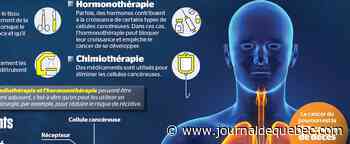 Les différentes thérapies contre le cancer