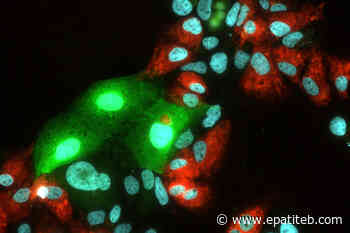 Studio tedesco: il virus dell'epatite C è in grado di sopprimere infezione concomitante da epatite E - Epatite B HBV
