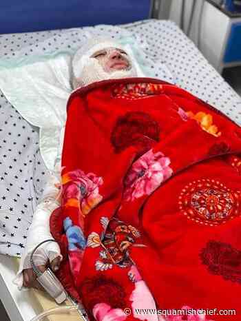 Death toll in Afghan mosque bombing rises to 33, Taliban say - Squamish Chief