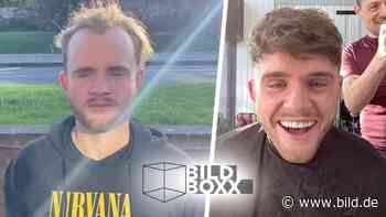 Goodbye Glatze: Dieses Fifis sind der Internet-Hit! - BILD