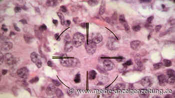 Entdeckung in Krebsforschung gemeldet: Wirkstoff soll Krebszellen verkleben