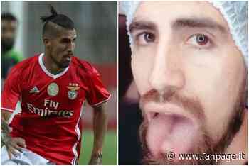 Follia di Junior Benitez, si opera per avere la lingua biforcuta: vuole assomigliare a un rettile - Sport Fanpage