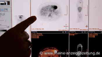 Krebsforschung: Neue Erkenntnisse – Wirkstoff soll Metastasen verhindern