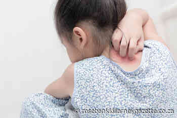 Dealing with skin rashes in children - Rosebank Killarney Gazette