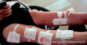 Felino, due ragazzini feriti dal lancio di un ordigno - Gazzetta di Parma