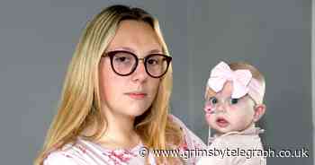 Young mother's frustration over the care her sick baby received at Grimsby hospital - Grimsby Live