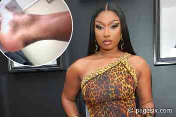 Megan Thee Stallion's medical report from shooting details bullet findings - Page Six
