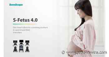 SonoScape lance le S-Fetus 4.0 pour simplifier le processus d'échographie