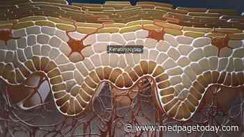 In Lupus, 'Normal-Appearing' Skin Is Not Normal
