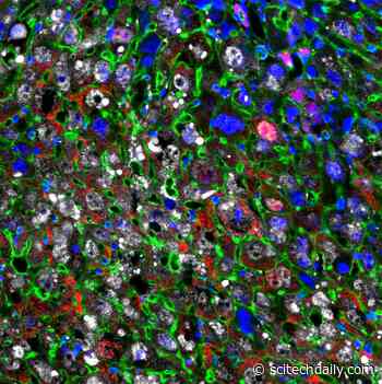Damaged Liver Tissue Restored Faster Than Ever With Cellular Regeneration Therapy