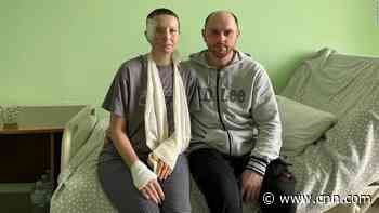 A Russian soldier asked how she lost her eye. Here is the awful truth