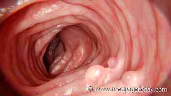 New Guidelines Target Cancer Risk in Rare GI Syndromes