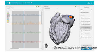 Vektor Medical to Present Positive Results from vMap Clinical Validation Study Showing 97.3% Mapping Accuracy for Atrial and Ventricular Arrhythmias - Business Wire