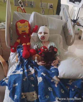 6-year-old Connecticut boy severely burned in alleged neighborhood attack