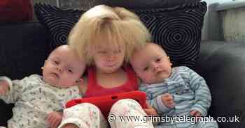 'Little lioness': Eight-year-old girl grows up loving uncombable hair - Grimsby Live - Grimsby Live