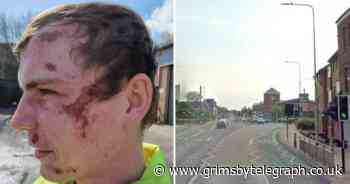 Girls praised for rushing to help Grimsby man having seizure in street - Grimsby Live